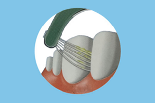 نوع متعدد الخطوط P